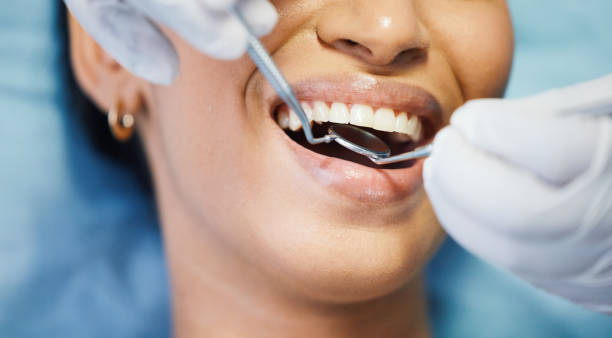 Best Emergency Root Canal Treatment in Elm Creek, TX