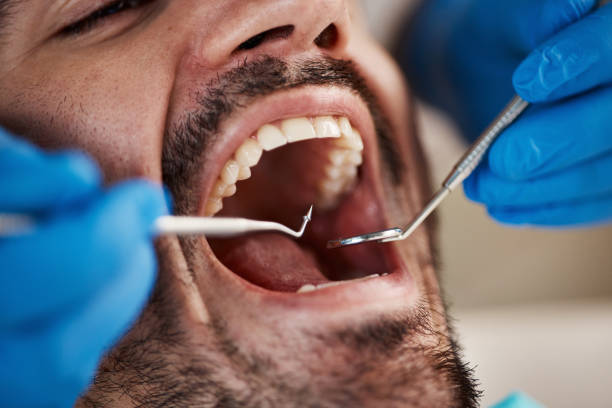 Best Emergency Denture Repair in Elm Creek, TX